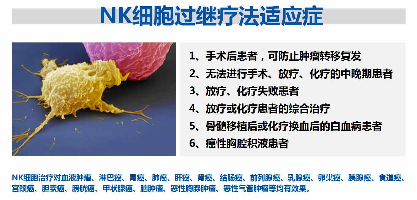 NK細(xì)胞過(guò)繼療法適應(yīng)癥