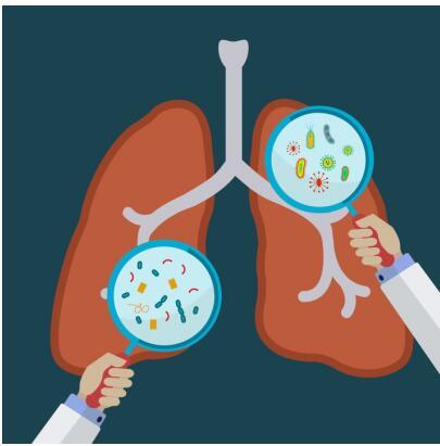 NK細(xì)胞免疫療法治療肺癌最新研究   